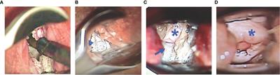 High-Resolution Quantitative Mapping of Macaque Cervicovaginal Epithelial Thickness: Implications for Mucosal Vaccine Delivery